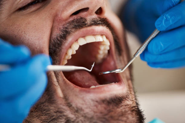 Best Emergency Dental Care for Broken or Chipped Teeth in Pecan Acres, TX